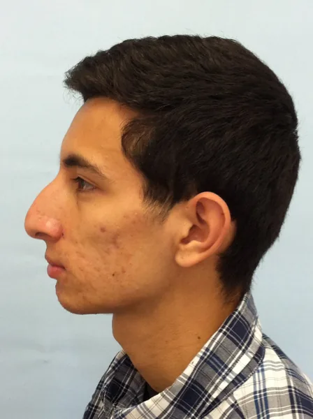 Additional Results — result photo, Dr. Faramarz Shabdiz, MD, Orange County, CA. Individual results vary.