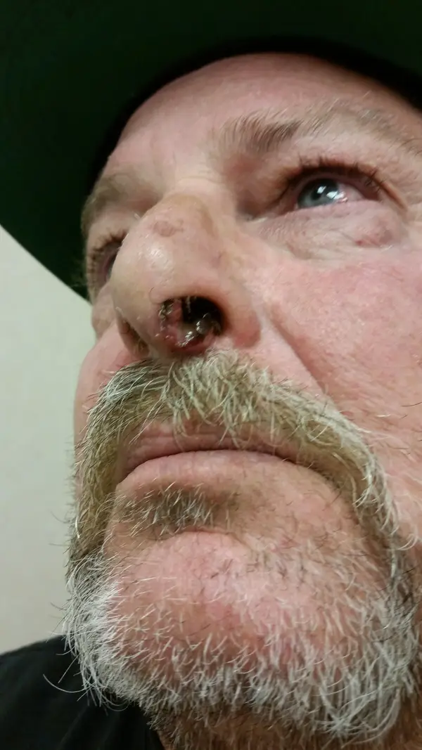 Facial reconstruction — before — Dr. Faramarz Shabdiz, MD. Individual results vary.