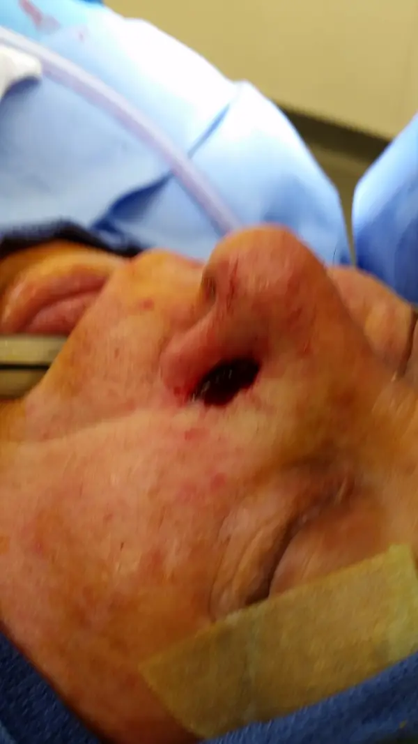 Facial reconstruction — before — Dr. Faramarz Shabdiz, MD. Individual results vary.