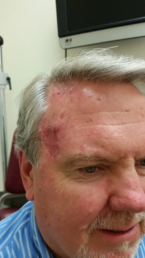 Facial reconstruction — after — Dr. Faramarz Shabdiz, MD. Individual results vary.
