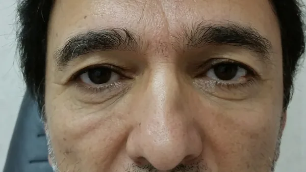 Additional Results — result photo, Dr. Faramarz Shabdiz, MD, Orange County, CA. Individual results vary.