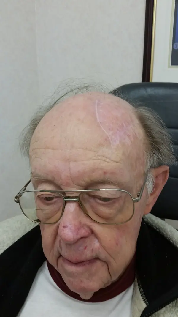Facial reconstruction — after — Dr. Faramarz Shabdiz, MD. Individual results vary.