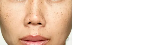 Theme demo, not a patient result, legacy file home-before-after-1