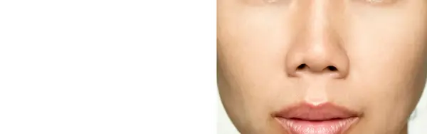 Theme demo, not a patient result, legacy file home-before-after-2