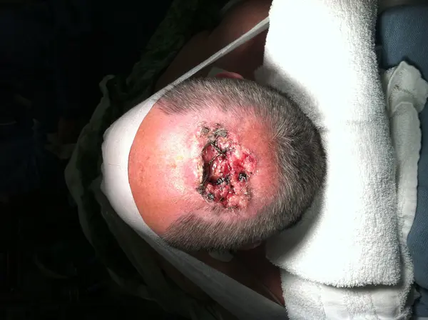 Facial reconstruction — before — Dr. Faramarz Shabdiz, MD. Individual results vary.