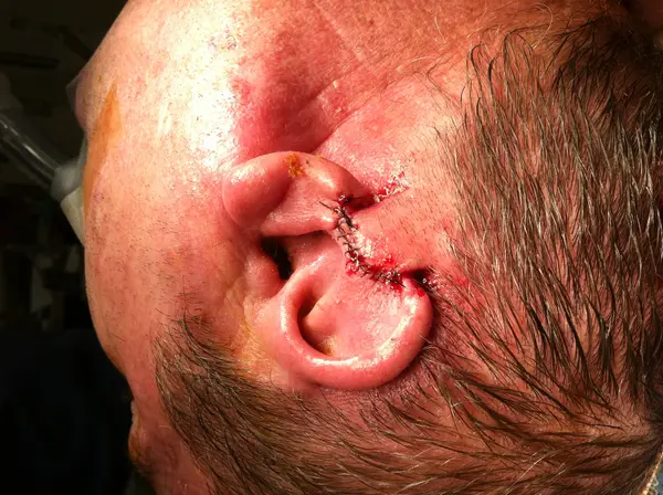 Facial reconstruction — after — Dr. Faramarz Shabdiz, MD. Individual results vary.