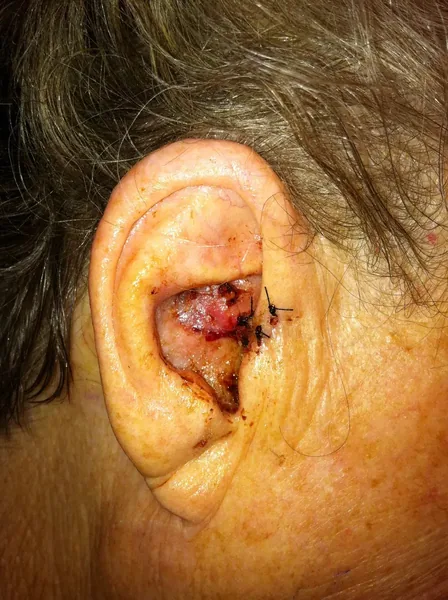 Facial reconstruction — after — Dr. Faramarz Shabdiz, MD. Individual results vary.