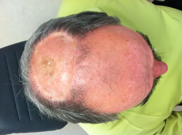 Facial reconstruction — after — Dr. Faramarz Shabdiz, MD. Individual results vary.
