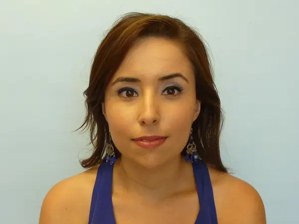 Rhinoplasty — before, front — Dr. Faramarz Shabdiz, MD. Individual results vary.