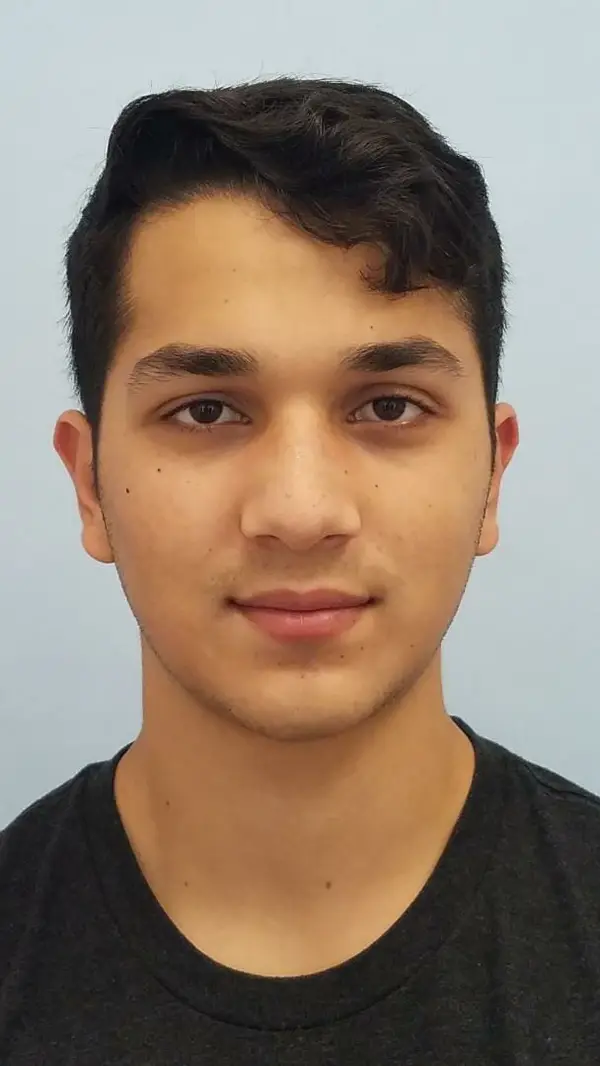 Rhinoplasty — after, front — Dr. Faramarz Shabdiz, MD. Individual results vary.