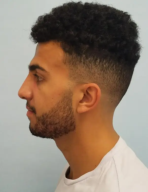 Rhinoplasty — after, left profile — Dr. Faramarz Shabdiz, MD. Individual results vary.