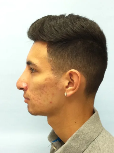 Additional Results — result photo, Dr. Faramarz Shabdiz, MD, Orange County, CA. Individual results vary.