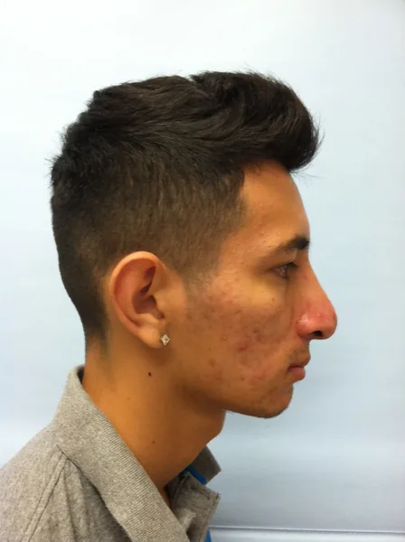 Additional Results — result photo, Dr. Faramarz Shabdiz, MD, Orange County, CA. Individual results vary.
