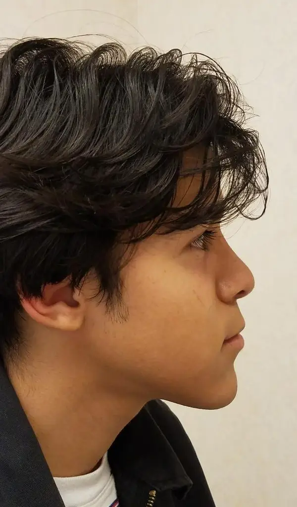 Rhinoplasty — after, right profile — Dr. Faramarz Shabdiz, MD. Individual results vary.