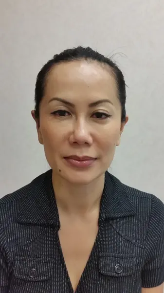 Otoplasty (ear surgery) — after, front — Dr. Faramarz Shabdiz, MD. Individual results vary.