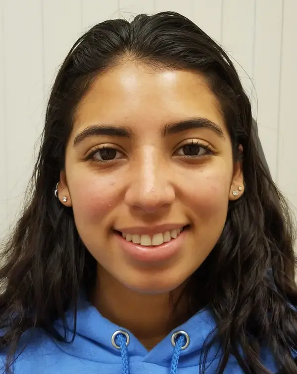 Rhinoplasty — after, smiling — Dr. Faramarz Shabdiz, MD. Individual results vary.