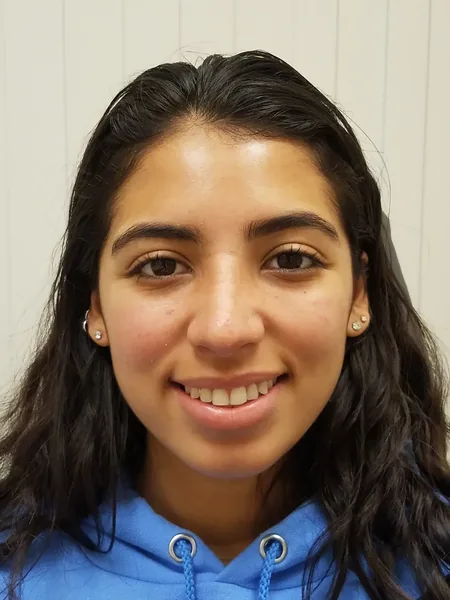 Additional Results — after photo, front view, Dr. Faramarz Shabdiz, MD, Orange County, CA. Individual results vary.