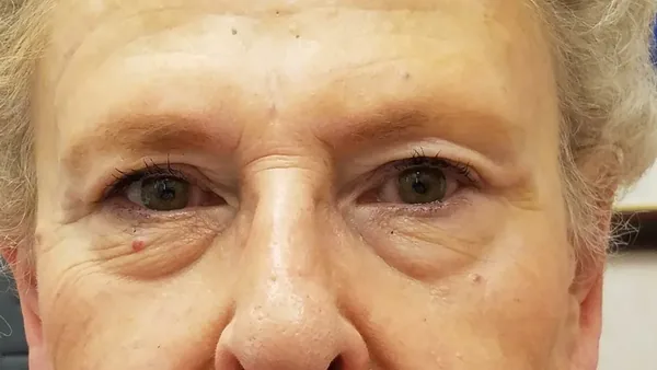 Additional Results — after photo, Dr. Faramarz Shabdiz, MD, Orange County, CA. Individual results vary.
