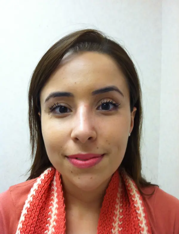 Rhinoplasty — after, front — Dr. Faramarz Shabdiz, MD. Individual results vary.