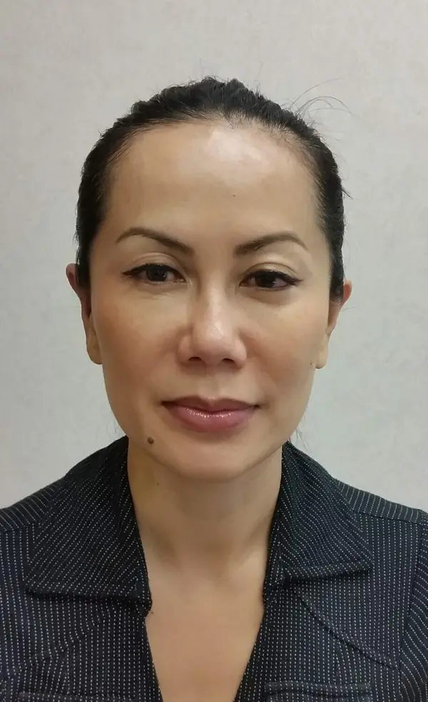 Rhinoplasty — after photo, Dr. Faramarz Shabdiz, MD, Orange County, CA. Individual results vary.