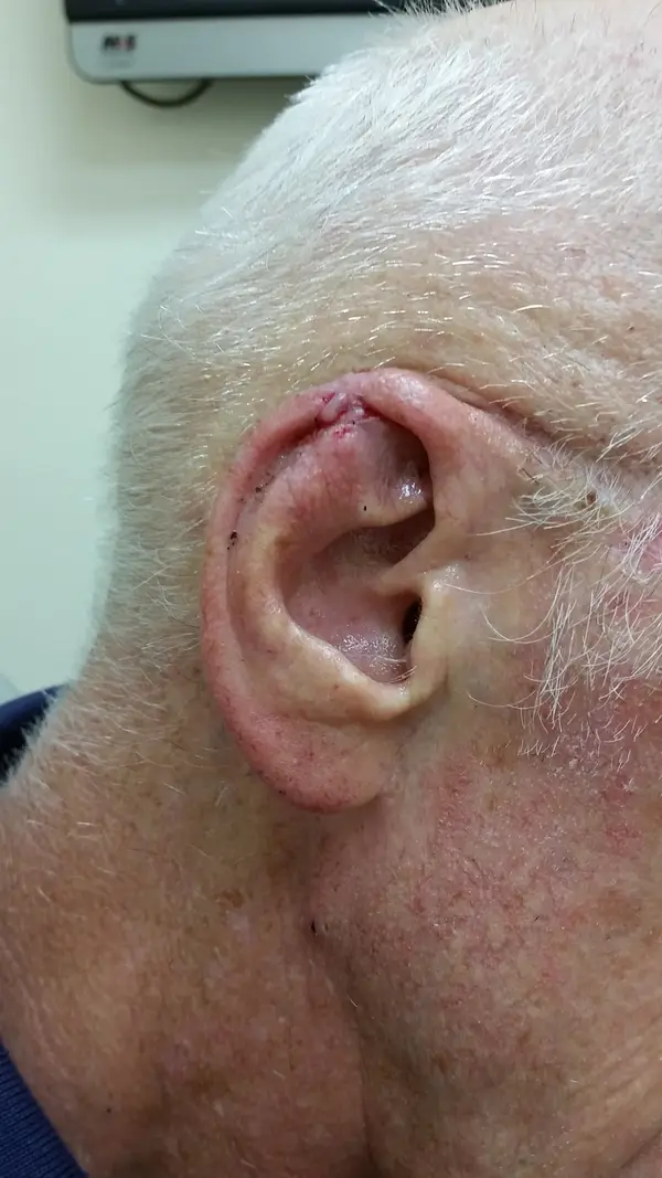Facial reconstruction — before — Dr. Faramarz Shabdiz, MD. Individual results vary.