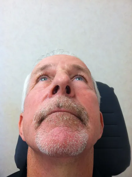 Rhinoplasty — before photo, base view, Dr. Faramarz Shabdiz, MD, Orange County, CA. Individual results vary.