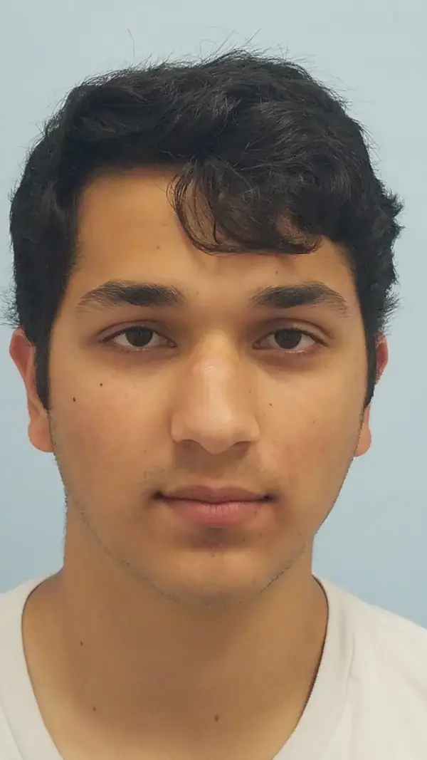 Rhinoplasty — before, front — Dr. Faramarz Shabdiz, MD. Individual results vary.